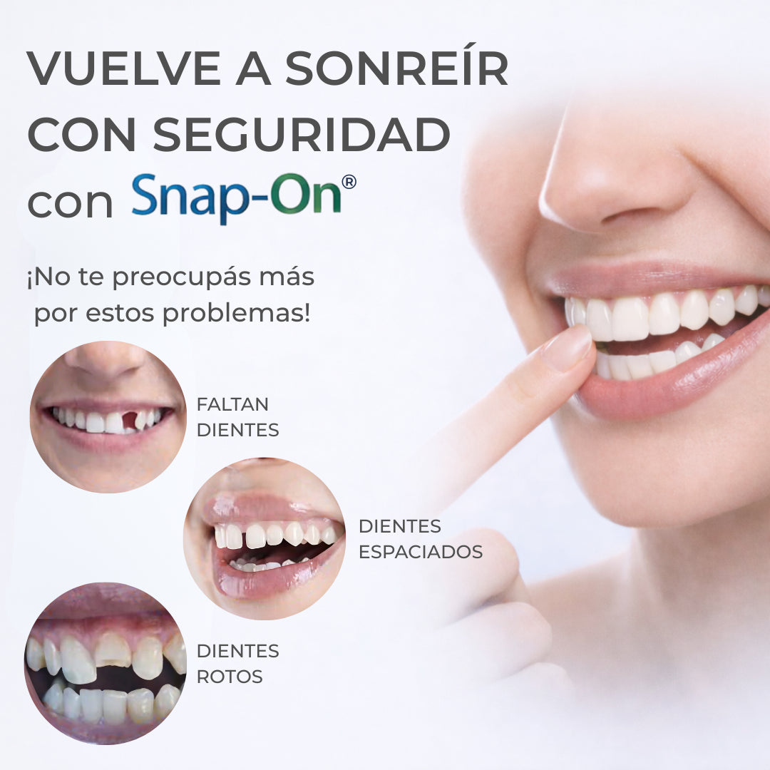 SNAP SMILE® CARILLAS DENTALES REMOVIBLES