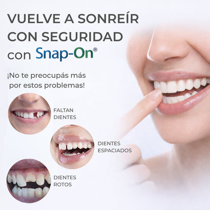 SNAP SMILE® CARILLAS DENTALES REMOVIBLES