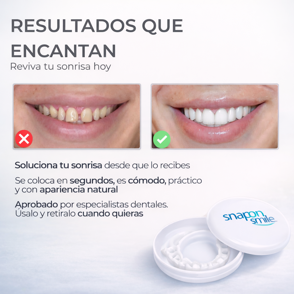 SNAP SMILE® CARILLAS DENTALES REMOVIBLES