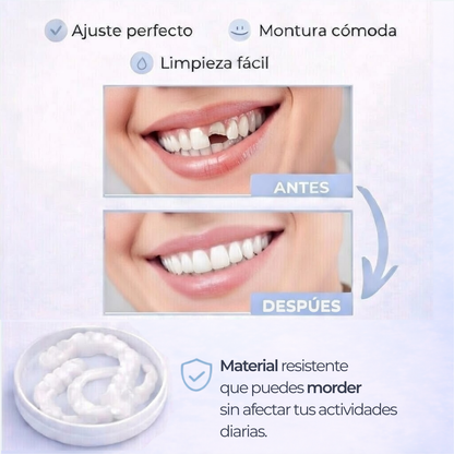 SNAP SMILE® CARILLAS DENTALES REMOVIBLES